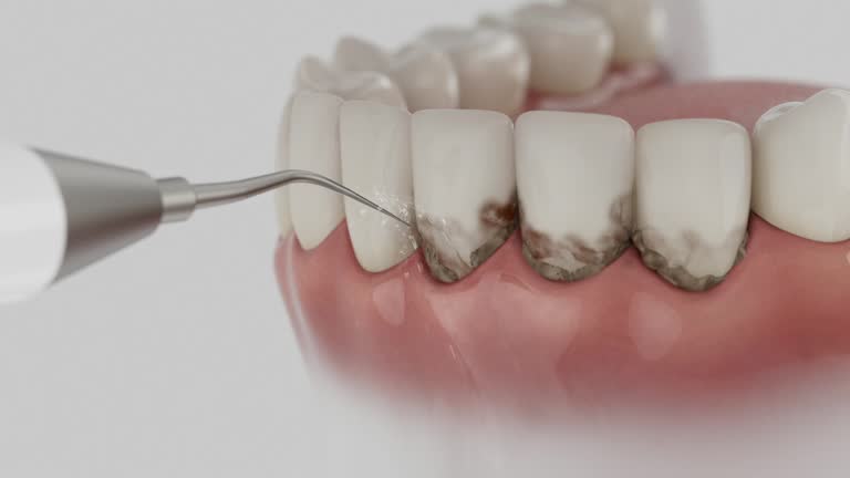Reliable Dental Implants contractor in Rockwell, NC by Smile Center Dentistry